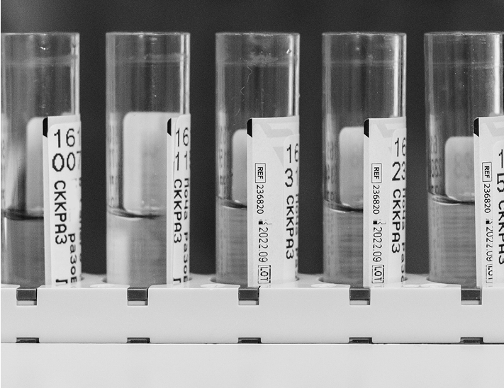 Standardised for results